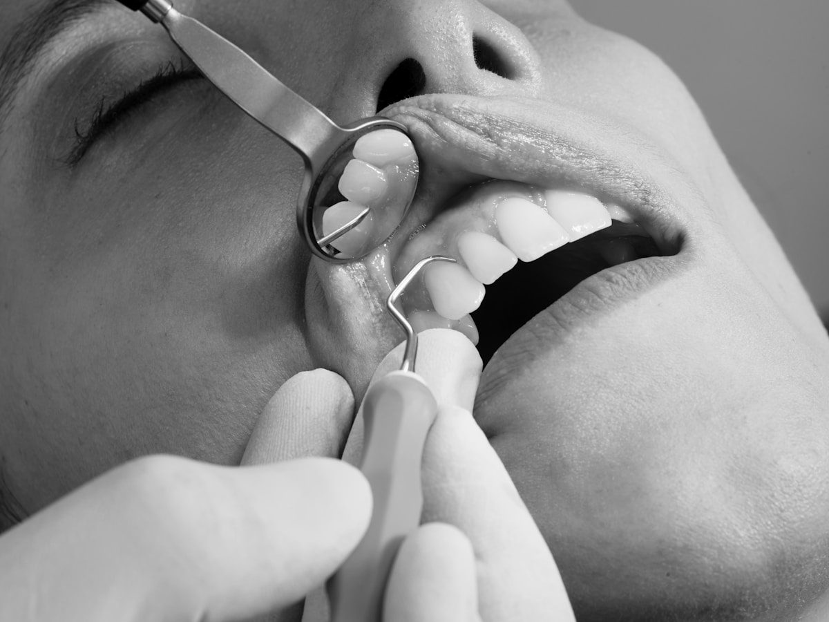 Read More About The Article 3 Types Of Dental Cleaning