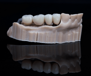 Read More About The Article Dental Bridges: Bridging The Gap To A Confident Smile