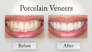 Cosmetic Dentist | Treatment Options For A Sparkling Smile Read More About The Article Cosmetic Dentist | Treatment Options For A Sparkling Smile