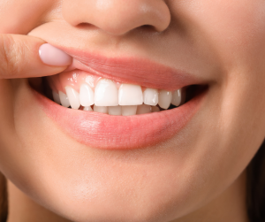 Read More About The Article Are Your Gums Failing? A Comprehensive Guide To Gum Health