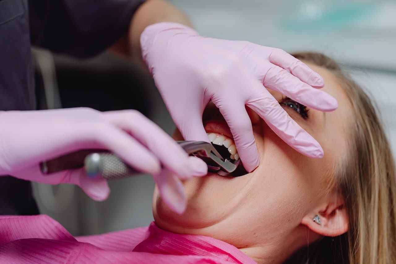 Read More About The Article The Different Types Of Dental Extractions: Simple Vs. Surgical