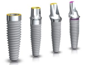 Announcing Noble Biocare Implant Options Read More About The Article Announcing Noble Biocare Implant Options