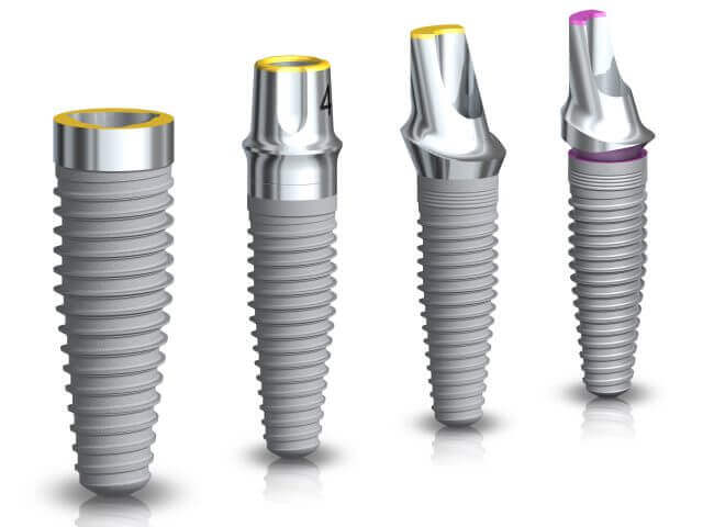 Announcing Noble Biocare Implant Options Read More About The Article Announcing Noble Biocare Implant Options
