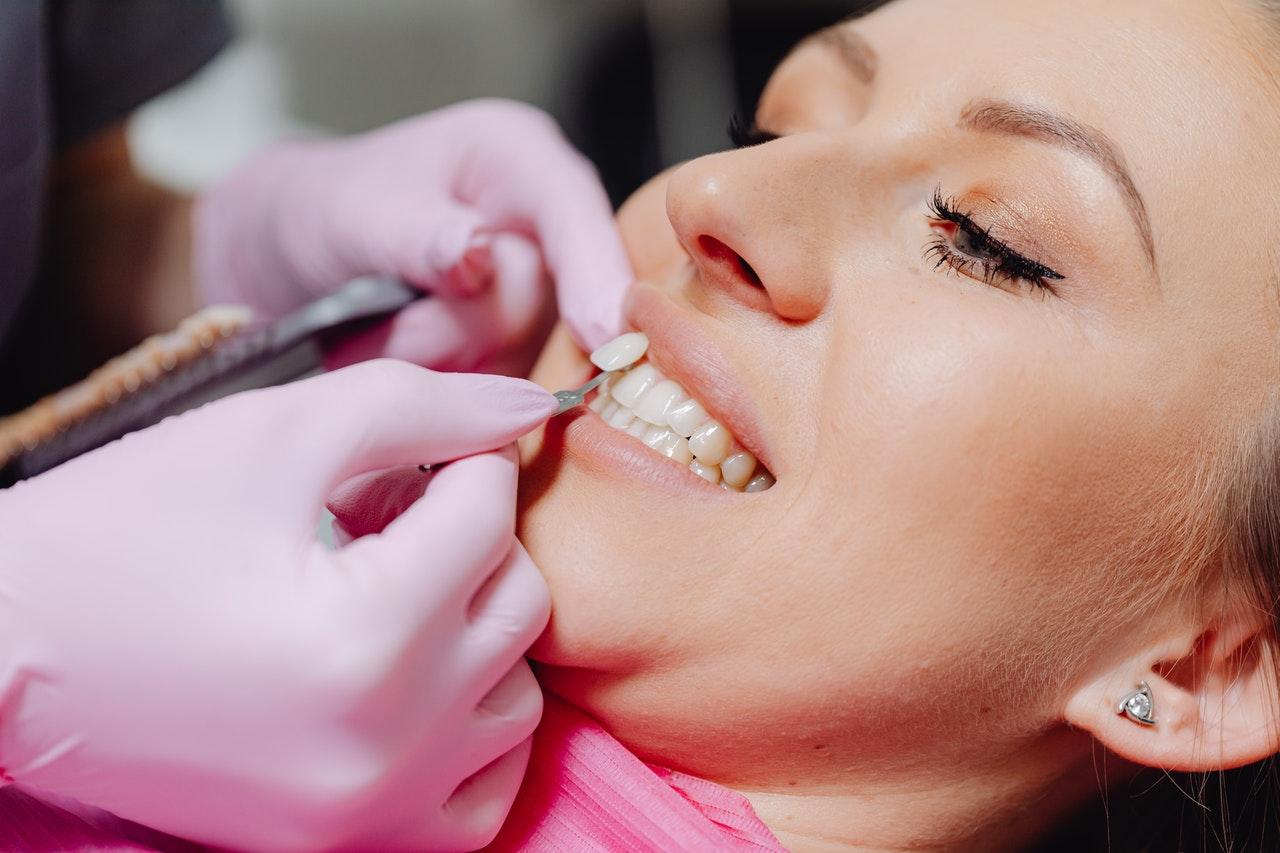 Read More About The Article Are Veneers Permanent?