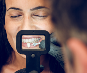 Transform Your Smile With Dental Veneers: What You Need To Know Read More About The Article Transform Your Smile With Dental Veneers: What You Need To Know