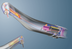 Read More About The Article Wonders Of Waterlase – Biolase Laser Periodontal Surgery